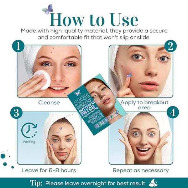 acne (1)