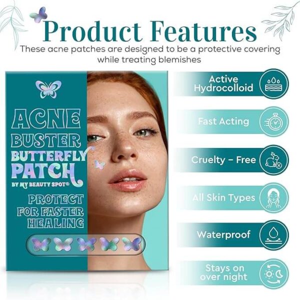acne (4)
